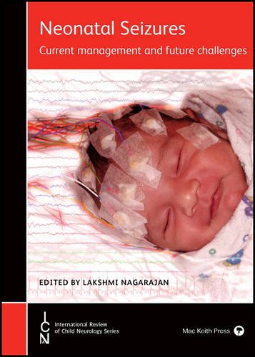 Neonatal Seizures: Current Management and Future Challenges (Original PDF from Publisher)