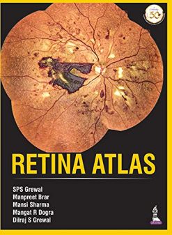 Retina Atlas (Original PDF from Publisher)