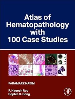 Atlas of Hematopathology with 100 Case Studies (Original PDF from Publisher)