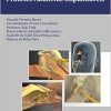 Tratado de Implante Coclear e Próteses Auditivas Implantáveis, 1st Edition (Original PDF from Publisher)