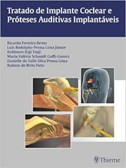 Tratado de Implante Coclear e Próteses Auditivas Implantáveis, 1st Edition (Original PDF from Publisher)