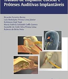 Tratado de Implante Coclear e Próteses Auditivas Implantáveis, 1st Edition (Original PDF from Publisher)