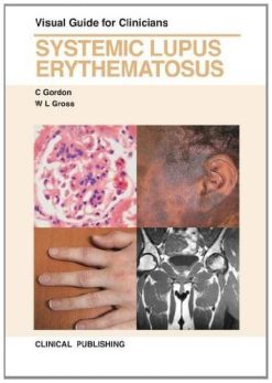 Systemic Lupus Erythematosus: Visual Guide for Clinicians (Original PDF from Publisher)