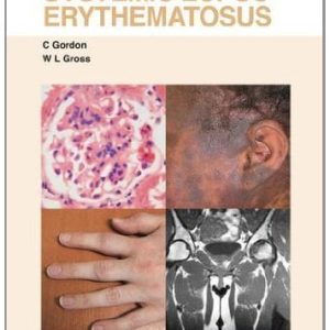 Systemic Lupus Erythematosus: Visual Guide for Clinicians (Original PDF from Publisher)