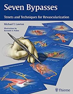 Seven Bypasses: Tenets and Techniques for Revascularization,1st edition (EPUB)