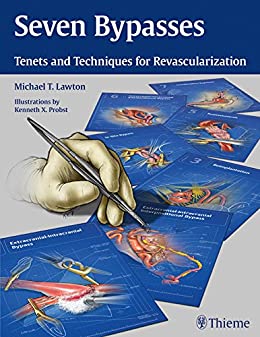 Seven Bypasses: Tenets and Techniques for Revascularization,1st edition (EPUB)