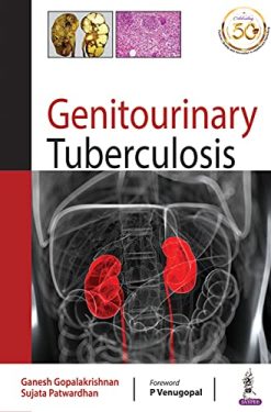 Genitourinary Tuberculosis (Original PDF from Publisher)
