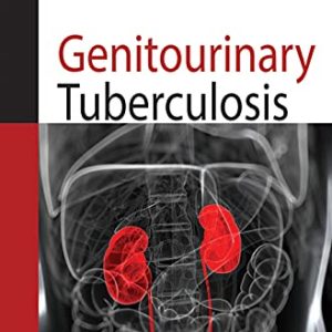 Genitourinary Tuberculosis (Original PDF from Publisher)