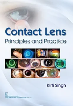 Contact Lens Printiples and Practice (Modern System of Ophthalmology (MSO) Series) (AZW3 + EPUB + Converted PDF)