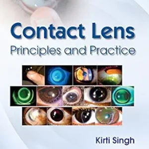 Contact Lens Printiples and Practice (Modern System of Ophthalmology (MSO) Series) (AZW3 + EPUB + Converted PDF)