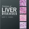 Pathology of Liver Diseases