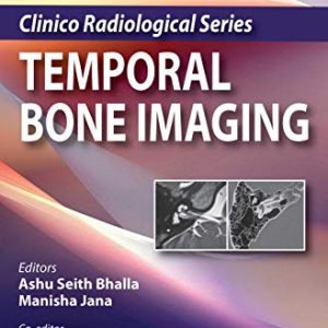 Clinico Radiological Series: Temporal Bone Imaging, 2nd Edition (Original PDF from Publisher)