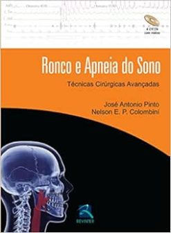 Ronco e Apneia do Sono: Técnicas Cirúrgicas Avançadas, 1st Edition (EPUB)