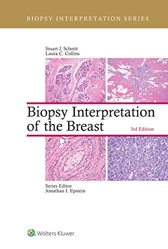Biopsy Interpretation of the Breast, 3rd Edition (EPUB+Converted PDF)