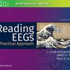 Reading EEGs: A Practical Approach, 2nd Edition (Original PDF from Publisher)