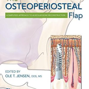 The Osteoperiosteal Flap: A Simplified Approach to Alveolar Bone Reconstruction (EPUB)