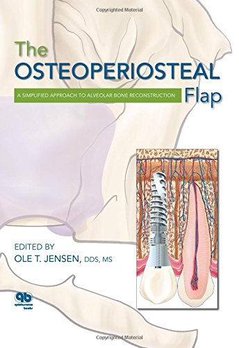 The Osteoperiosteal Flap: A Simplified Approach to Alveolar Bone Reconstruction (EPUB)