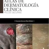Atlas de dermatología clínica: Pieles oscuras (Salud) (Spanish Edition) (EPUB)