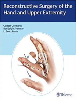 Reconstructive Surgery of the Hand and Upper Extremity (EPUB)
