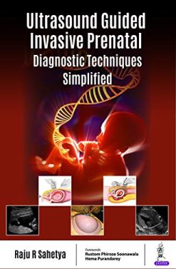 Ultrasound Guided Invasive Prenatal Diagnostic Techniques Simplified (Original PDF from Publisher)