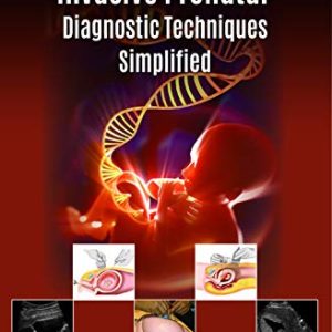 Ultrasound Guided Invasive Prenatal Diagnostic Techniques Simplified (Original PDF from Publisher)