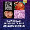 Diagnosis and Treatment of Rare Gynecologic Cancers (True PDF)