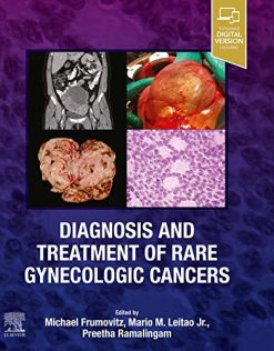 Diagnosis and Treatment of Rare Gynecologic Cancers (True PDF)