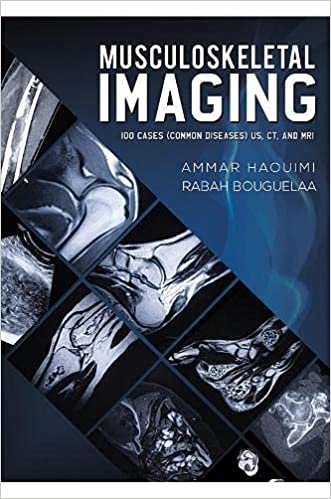 Musculoskeletal Imaging: 100 Cases (Common Diseases) US, CT and MRI (EPUB)