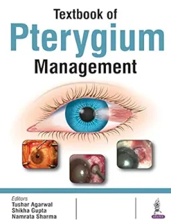 Textbook of Pterygium Management (Original PDF from Publisher)
