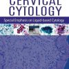 Handbook of Cervical Cytology: Special Emphasis on Liquid Based Cytology (Original PDF from Publisher)