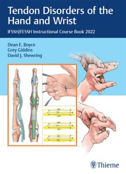 Tendon Disorders of the Hand and Wrist: IFSSH/FESSH Instructional Course Book 2022 (Original PDF from Publisher)