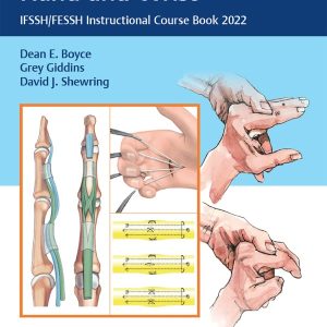 Tendon Disorders of the Hand and Wrist: IFSSH/FESSH Instructional Course Book 2022 (Original PDF from Publisher)