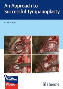 An Approach to Successful Tympanoplasty (Original PDF from Publisher+Videos)