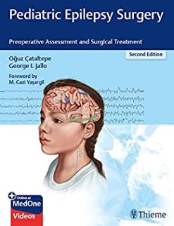 Pediatric Epilepsy Surgery: Preoperative Assessment and Surgical Treatment, 2nd Edition (EPUB)