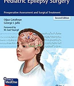 Pediatric Epilepsy Surgery: Preoperative Assessment and Surgical Treatment, 2nd Edition (EPUB)