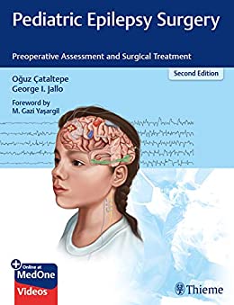 Pediatric Epilepsy Surgery: Preoperative Assessment and Surgical Treatment, 2nd Edition (EPUB)