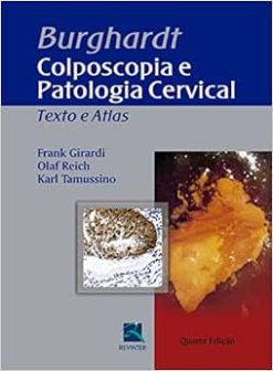 Burghardt: Colposcopia e Patologia Cervical, 4th Edition (Original PDF from Publisher)