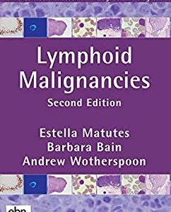 Lymphoid Malignancies, 2nd edition (Original PDF from Publisher)