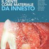 Il dente come materiale da innesto (EPUB3 + Converted PDF)