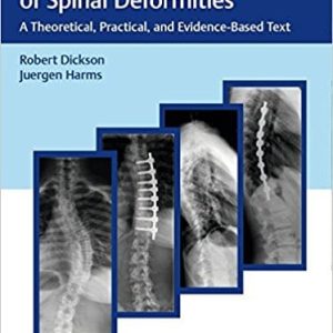 Modern Management of Spinal Deformities: A Theoretical, Practical, and Evidence-based Text (Original PDF from Publisher)