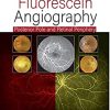 Practical Handbook of Fluorescein Angiography: Posterior Pole and Retinal Periphery, 2nd Edition (Original PDF from Publisher)