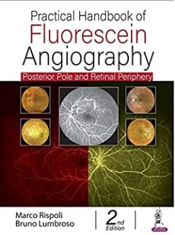 Practical Handbook of Fluorescein Angiography: Posterior Pole and Retinal Periphery, 2nd Edition (Original PDF from Publisher)