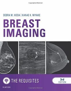 Breast Imaging: The Requisites, 3rd Edition (Requisites in Radiology) (Original PDF from Publisher)