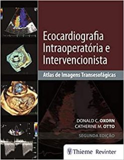 Ecocardiografia Intraoperatória e Intervencionista: Atlas de Imagens Tansesofágicas, 2nd Edition (Original PDF from Publisher)