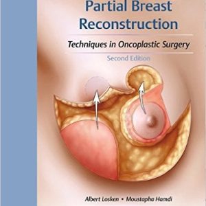Partial Breast Reconstruction: Techniques in Oncoplastic Surgery, 2nd Edition (Original PDF + Videos)