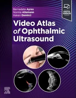 Video Atlas of Ophthalmic Ultrasound (EPUB)