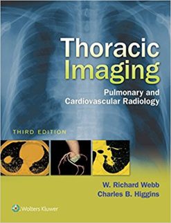 Thoracic Imaging: Pulmonary and Cardiovascular Radiology, 3rd Edition (EPUB)