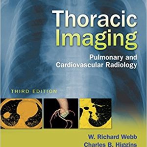 Thoracic Imaging: Pulmonary and Cardiovascular Radiology, 3rd Edition (EPUB)