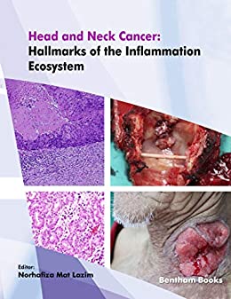 Head and Neck Cancer: Hallmarks of The Inflammation Ecosystem-Volume 2 (EPUB & Converted PDF)