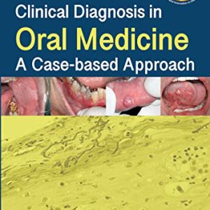 Clinical Diagnosis in Oral Medicine: A Case-based Approach (Original PDF from Publisher)